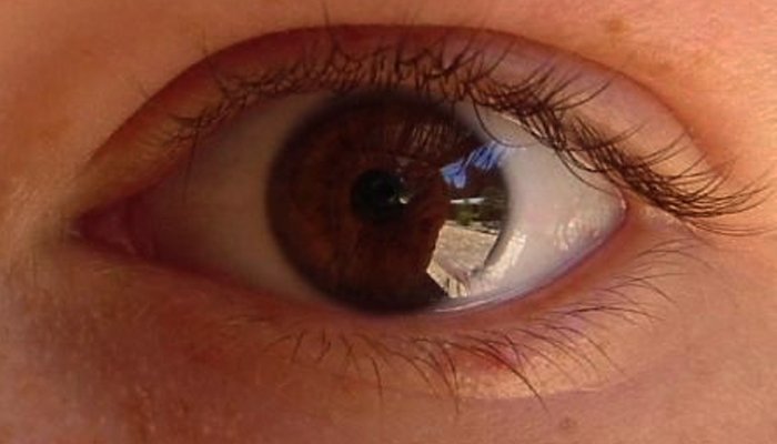 vision impairment - retinitis pigmentosa treatment